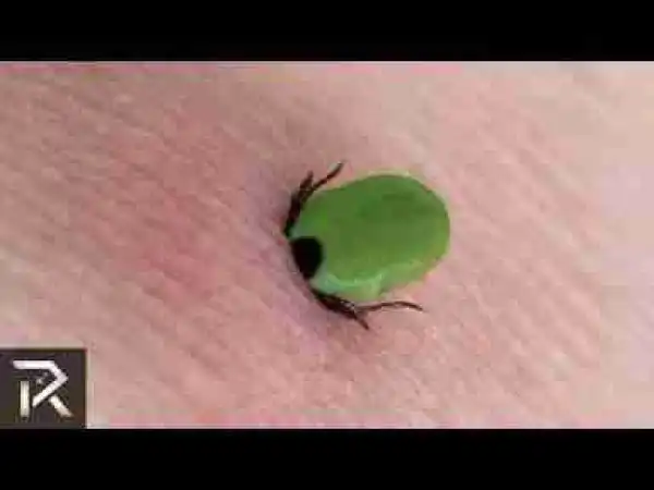 Video: 10 Creatures That Can Crawl Into Bodies